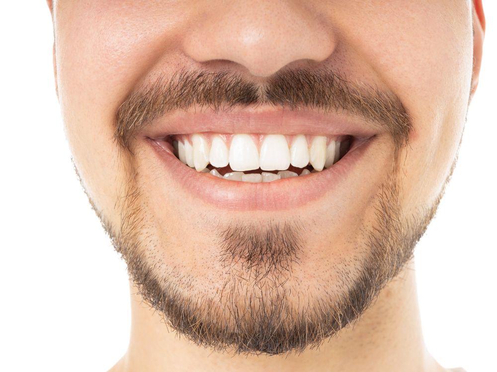 Como um sorriso artificial transforma a sua estética 